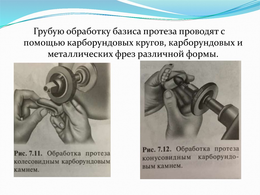 Бизнес план протезирование конечностей