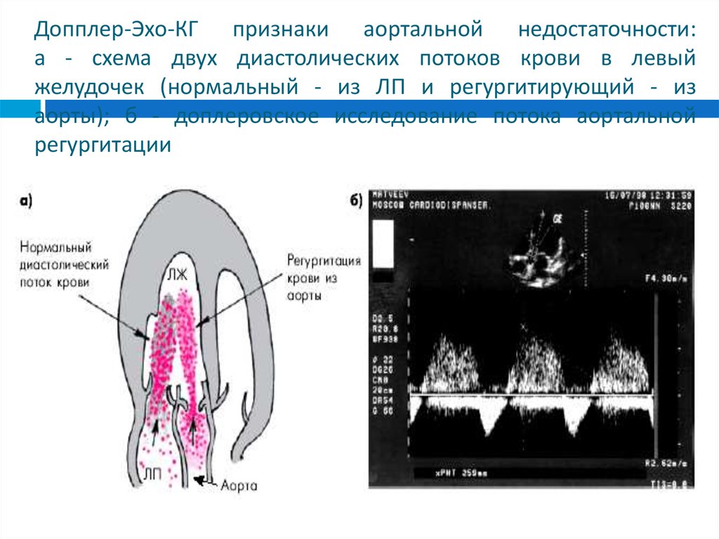 Эхо признаки