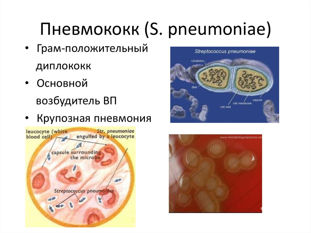 Пневмококки микробиология презентация