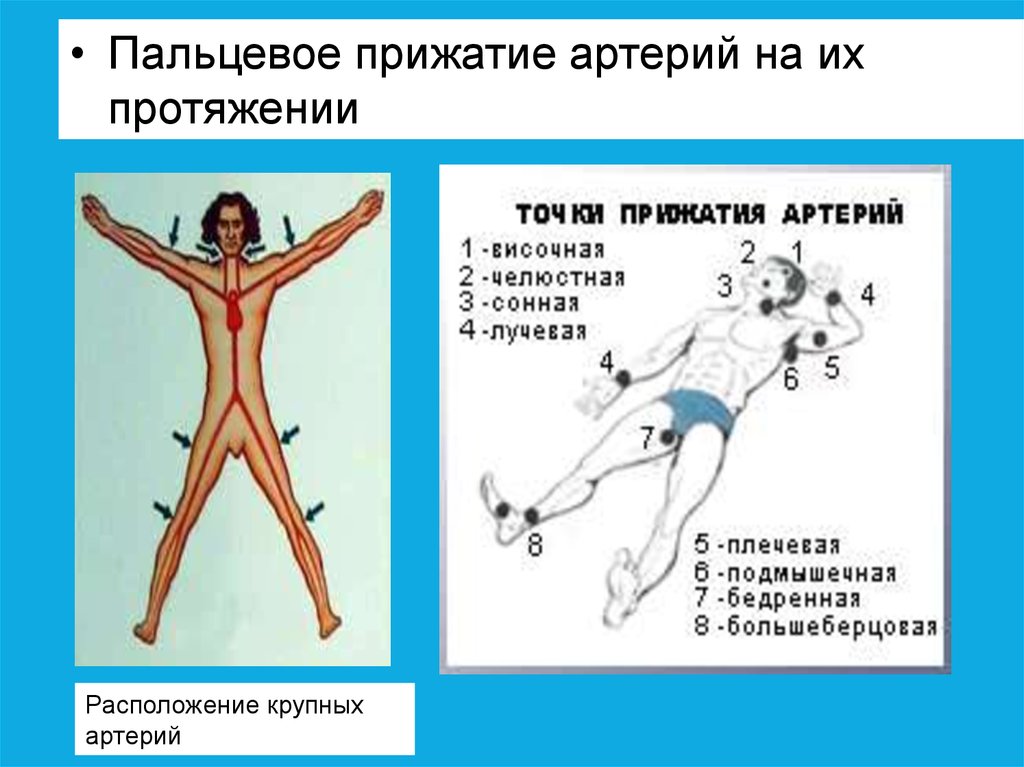 На протяжении более. Пальцевое прижатие сосуда на протяжении. Пальцевое прижатие артерий натпротяжении. Пальзевое пережатие артерии на протяжении. Прижатие артерии на протяжении.