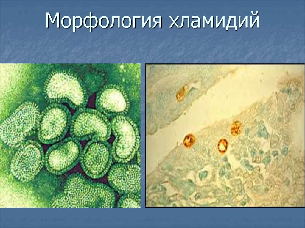 Хламидия chlamydia. Морфология хламидии трахоматис. Хламидии морфология микробиология. Жизненный цикл хламидии микробиология. Урогенитальный хламидиоз возбудитель.
