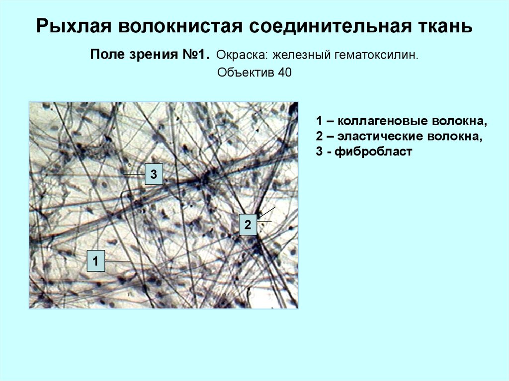 Волокнистая ткань. Рыхлая волокнистая соединительная ткань окраска. Рыхлая волокнистая соединительная ткань функции. Окраска эластических волокон. Рыхлая волокнистая фибробласты.