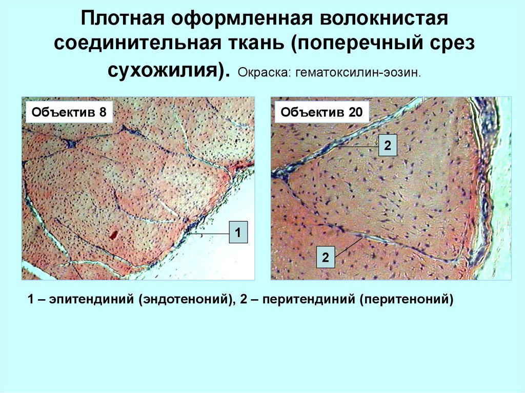 Плотная волокнистая соединительная ткань. Плотная оформленная соединительная ткань поперечный срез сухожилия. Эндотеноний и перитеноний.