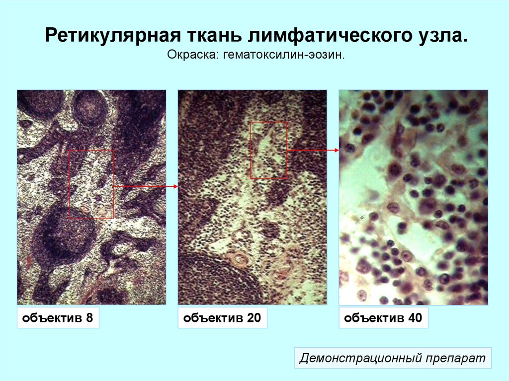 Рисунок ретикулярной ткани