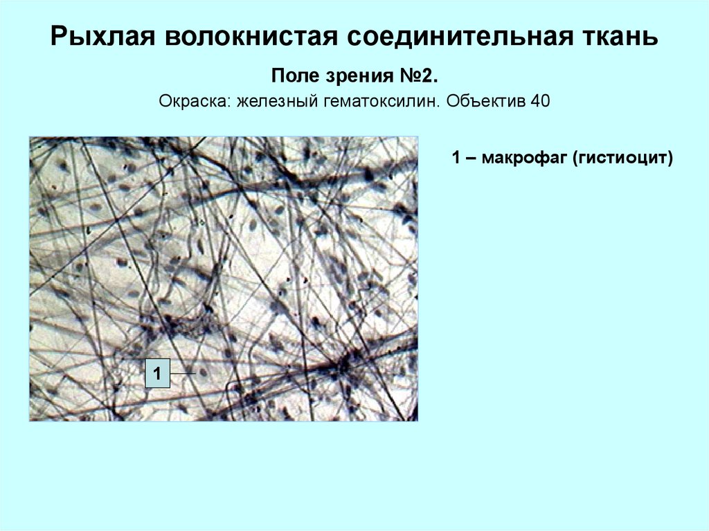 Рыхлая ткань. Рыхлая волокнистая соединительная ткань Железный гематоксилин. Рыхлая соединительная ткань Железный гематоксилин. Рыхлая соединительная ткань окраска железным гематоксилином. Рыхлая волокнистая соединительная ткань окраска.