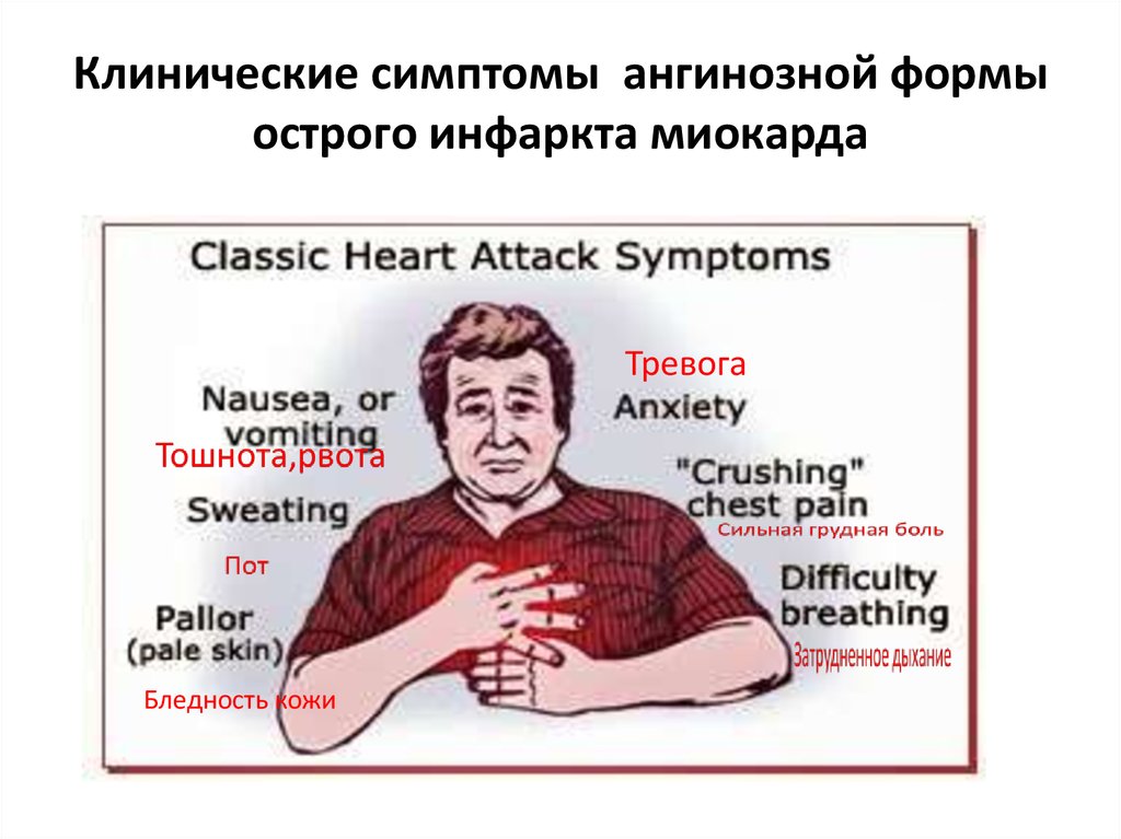 Признаки инфаркта у мужчин 40 симптомы