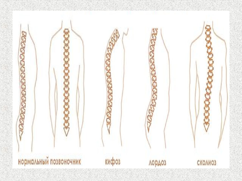 Форма позвоночника. Нормальная форма спины. Нормальный позвоночник. Лордоз кифоз сколиоз.