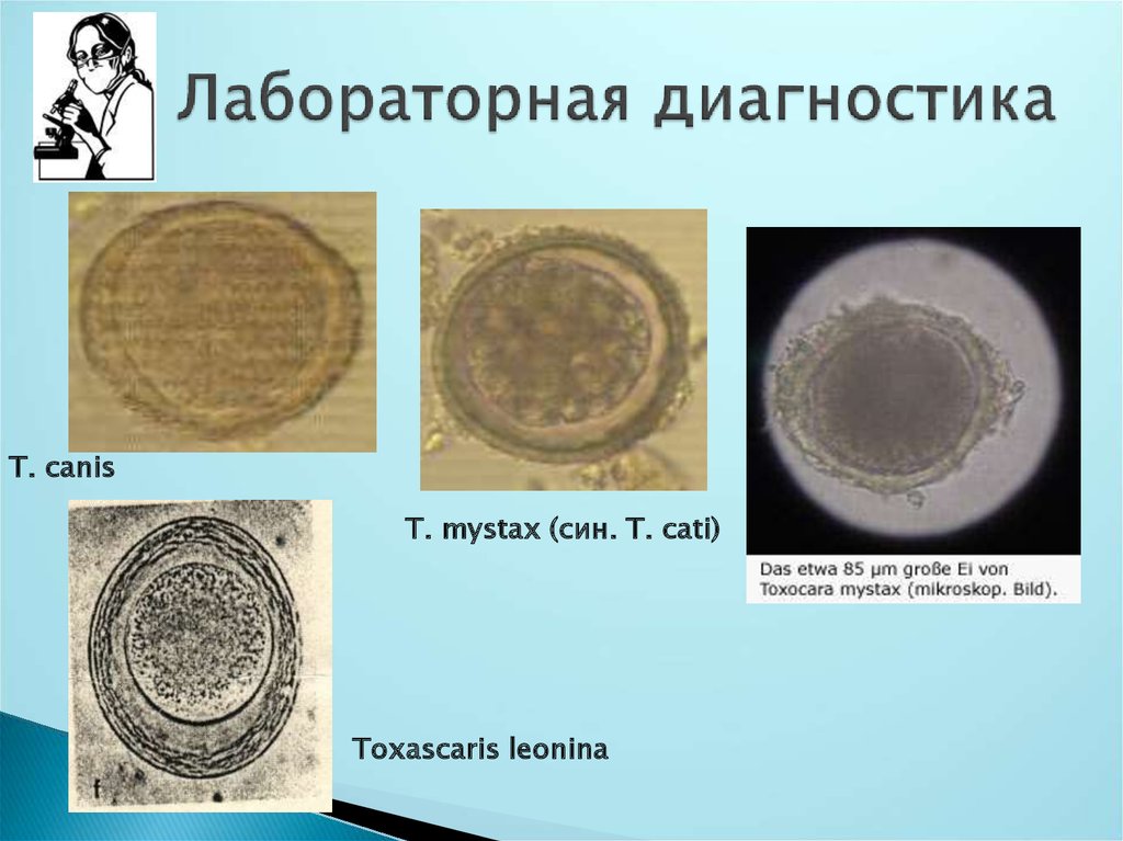 Токсокара у взрослых фото