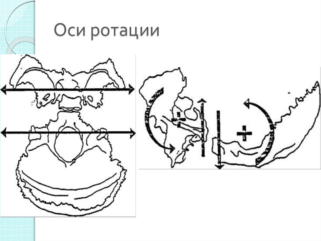 Оси движения. Сфенобазилярный симфиз. Сфено-базиллярный синходроз. Дисфункция сфенобазилярного синхондроза. Торсия черепа.