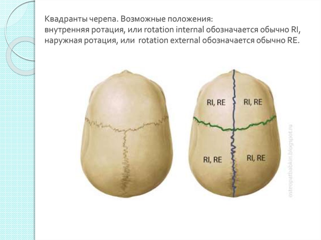 Наружном квадранте. Внутренний Квадрант черепа. Торсия черепа. Ротация черепа.