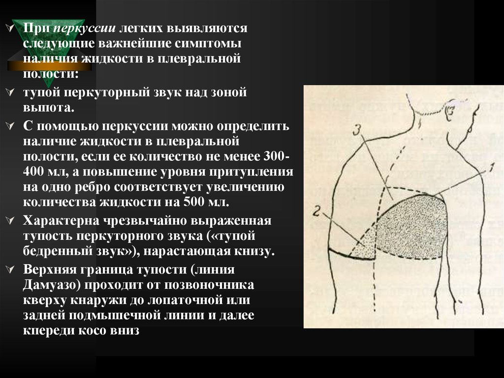 Гидроторакс легких карта вызова