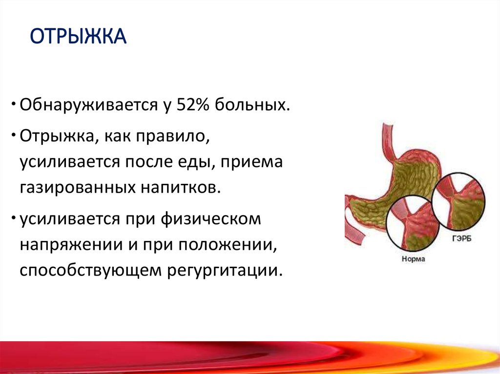 Отрыжка без запаха после еды. Как научиться делать отрыжку. Отрыжка. Отрыжка после газировки.