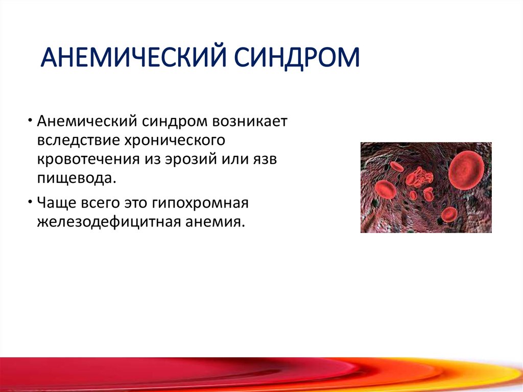 Анемический синдром презентация