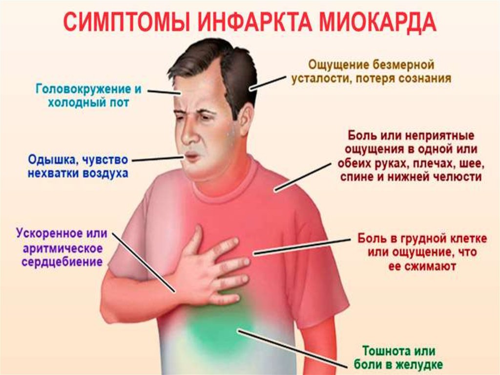 Нехватка воздуха боли в грудной клетке. Сердечный приступ. Бессимптомный инфаркт миокарда. Инфаркт миокарда симптомы. Сердечный приступ симптомы.