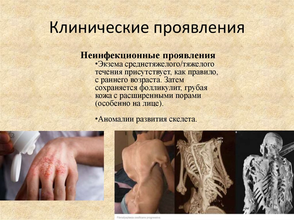 Клинические проявления