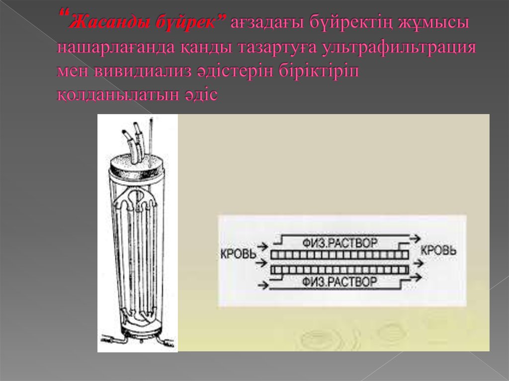 “Жасанды бүйрек” ағзадағы бүйректің жұмысы нашарлағанда қанды тазартуға ультрафильтрация мен вивидиализ әдістерін біріктіріп