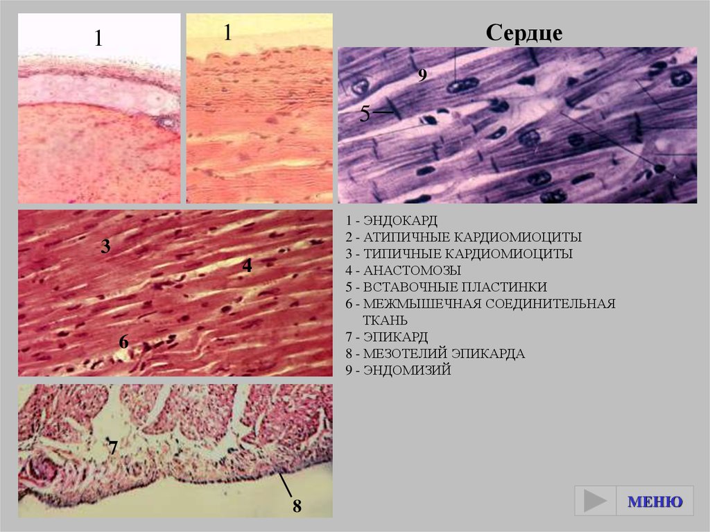 Эндокард рисунок гистология