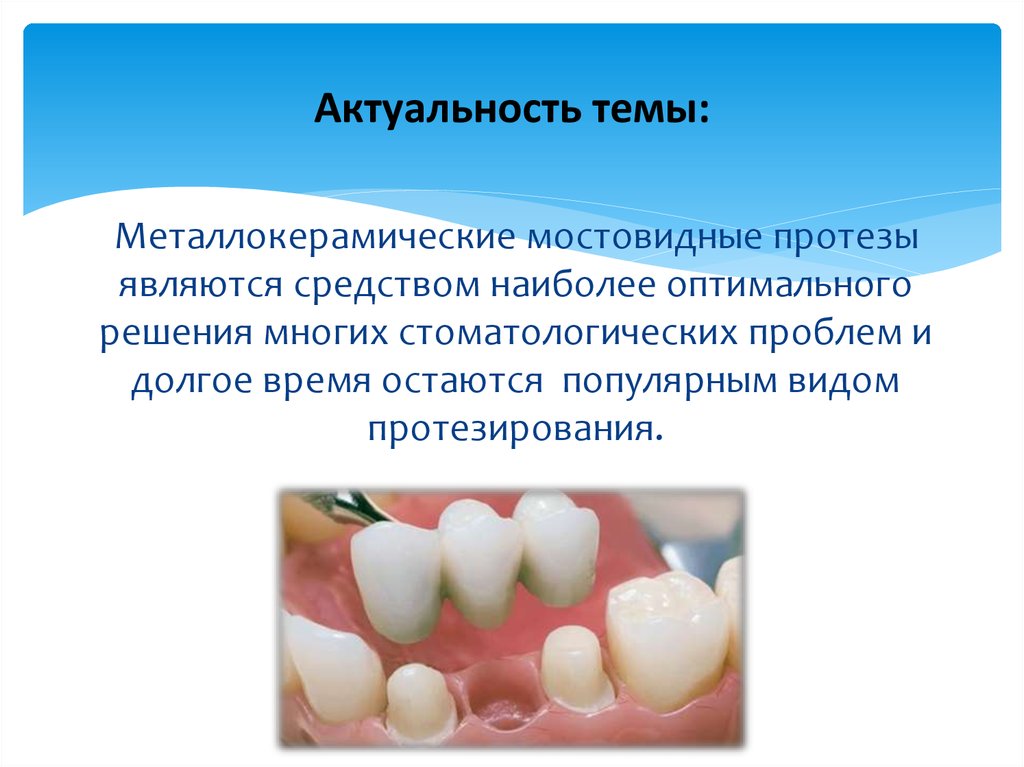 Изготовление мостовидных протезов презентация