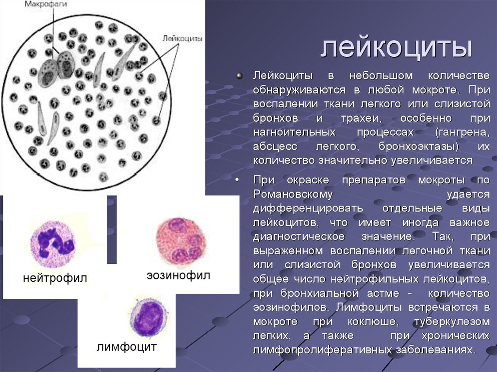 Макрофаги 1 2. Эозинофилы в мокроте микроскопия. Лейкоциты в мокроте микроскопия. Лейкоциты в мокроте норма. Нейтрофильные лейкоциты в мокроте.