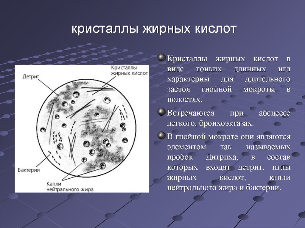 Включения в мокроте