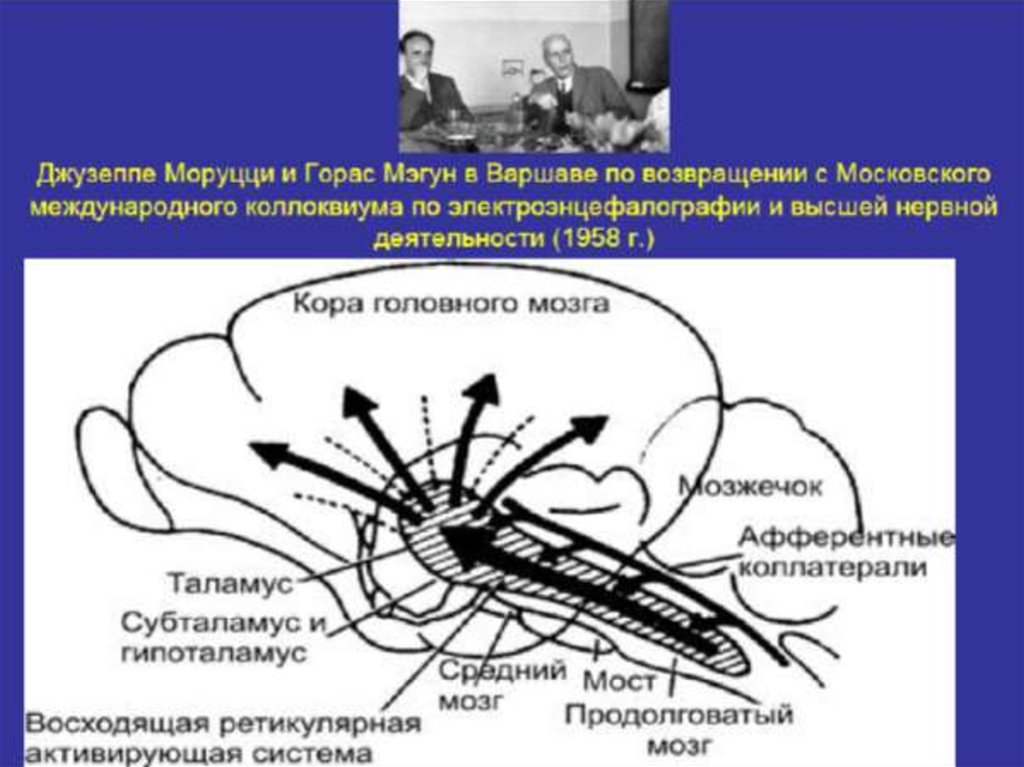 Нарисуйте ээг кошки после разрушения ядер восходящей ретикулярной активирующей системы врас