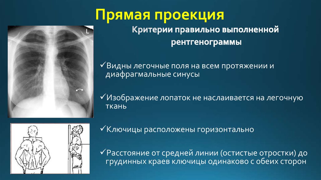 Проекции рентгенограммы. Проекции в лучевой диагностике. Проекции в рентгенологии. Прямая проекция рентгенограммы. Прямая передняя проекция в рентгенологии.