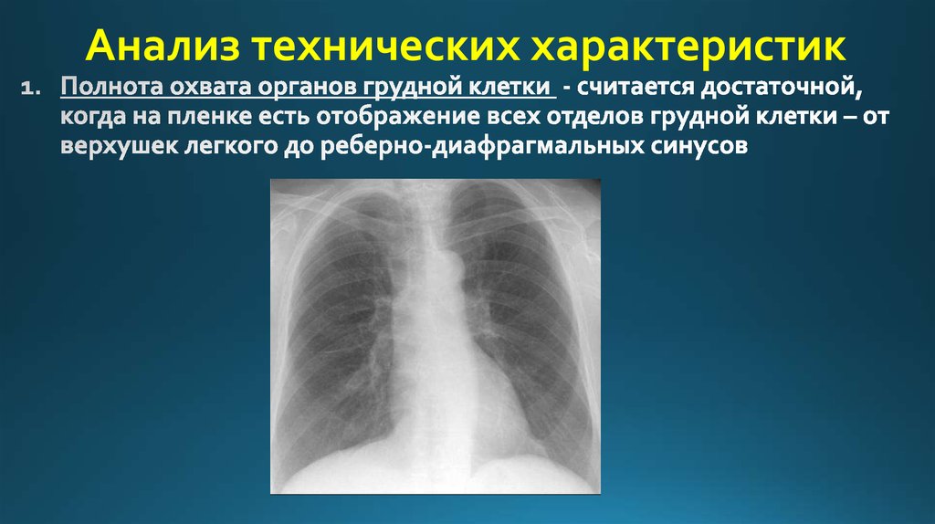 Методы лучевой диагностики органов дыхания презентация