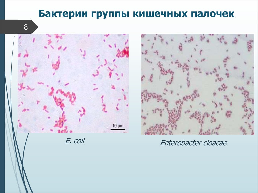 Escherichia coli рисунок микробиология