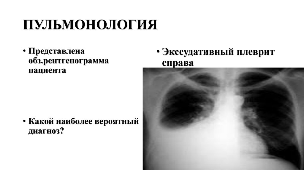 ПУЛЬМОНОЛОГИЯ