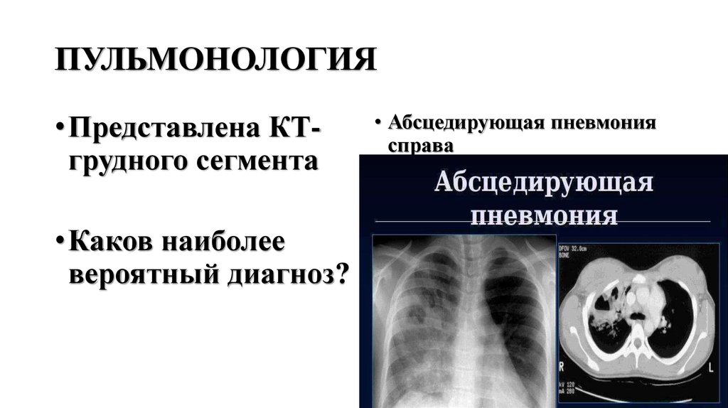 ПУЛЬМОНОЛОГИЯ