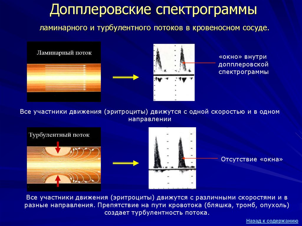 Ламинарный поток. Ламинарный и турбулентный поток. Ламинарный поток в сосудах. Турбулентное течение крови.