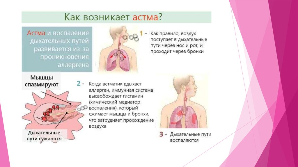 Как заболевают астмой. Отчего появляется астма. Из за чего возникает астма.