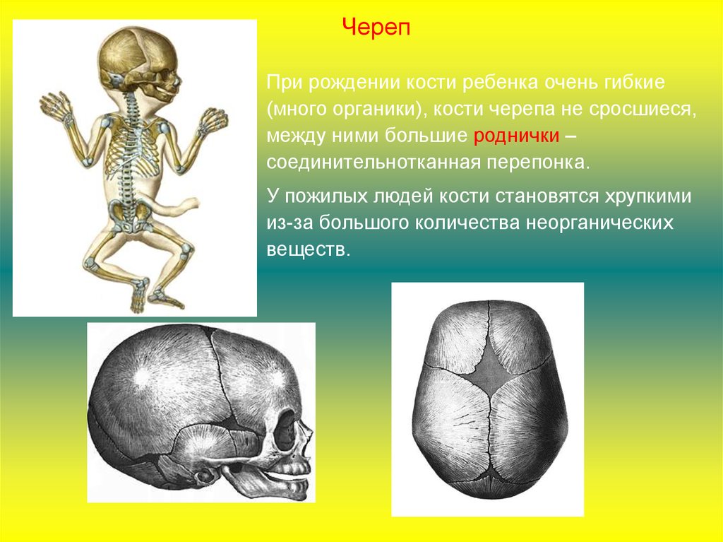 Кости новорожденного. Кости скелета ребенка. Кости ребенка характеризуются. Кол во костей черепа ребенка-детский.