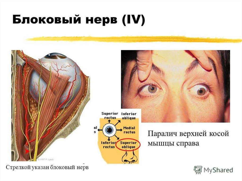 Блоковый нерв неврология презентация