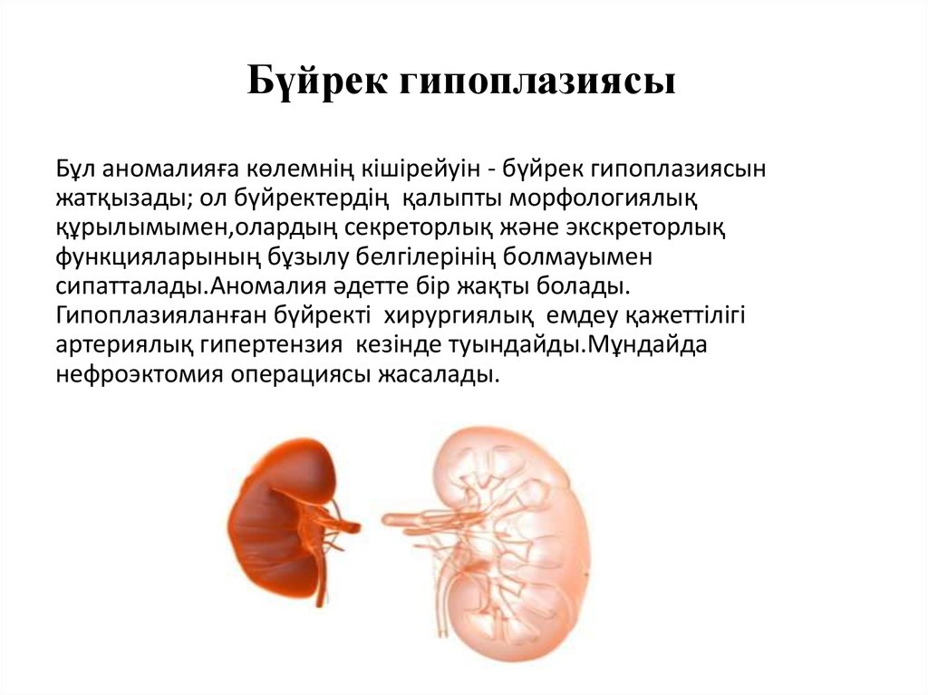 Нефроэктомия