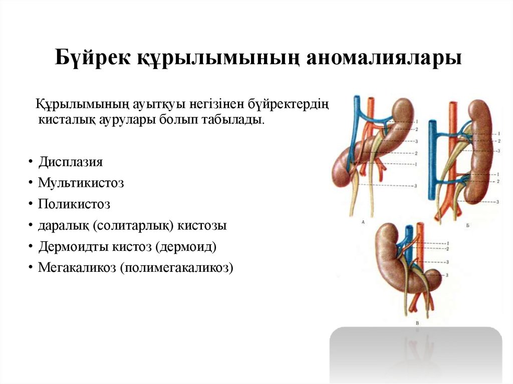 Бүйрек коликасы презентация