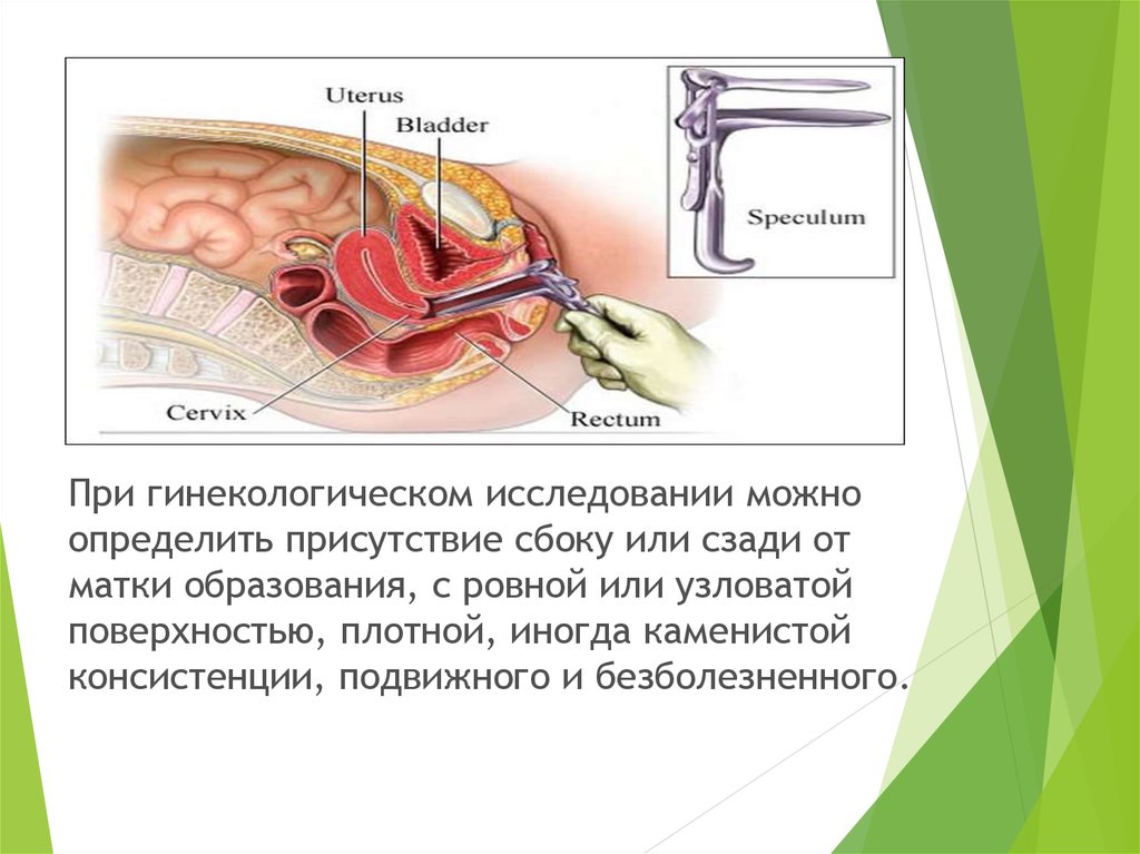 Влагалищное исследование. Что определяют при влагалищном исследовании. Ректальное исследование в гинекологии. Влагалищное исследование для определения плоскости. Влагалищное исследование при лицевом.