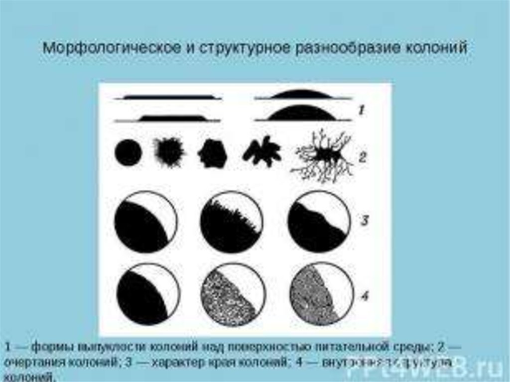 Свойства колонии. Края колоний микроорганизмов микробиология. Структура колоний микроорганизмов. Строение колоний микроорганизмов. Формы колоний микробиология.