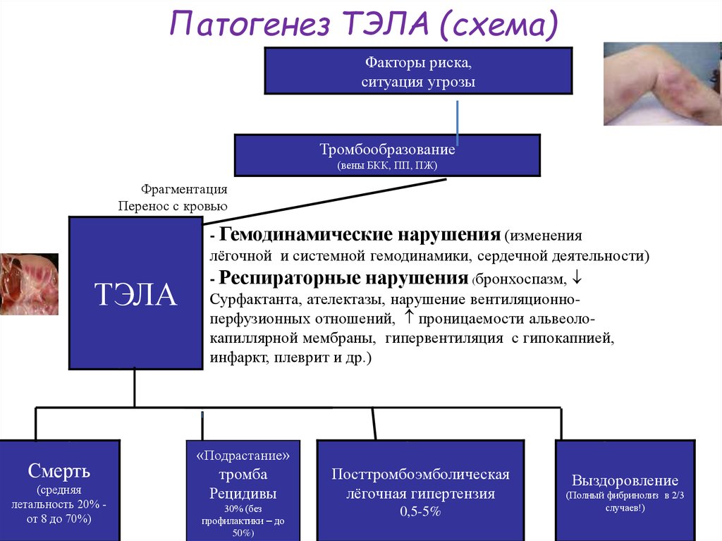 Тромбоэмболия легочной артерии презентация патофизиология