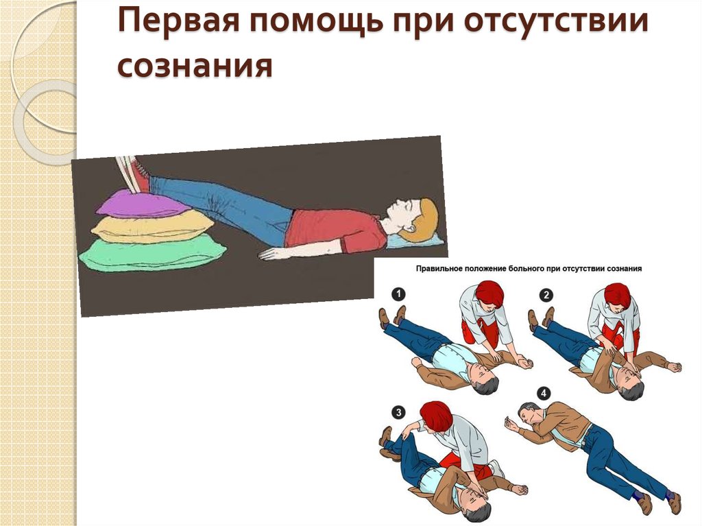 Первая помощь при отсутствии кровообращения презентация