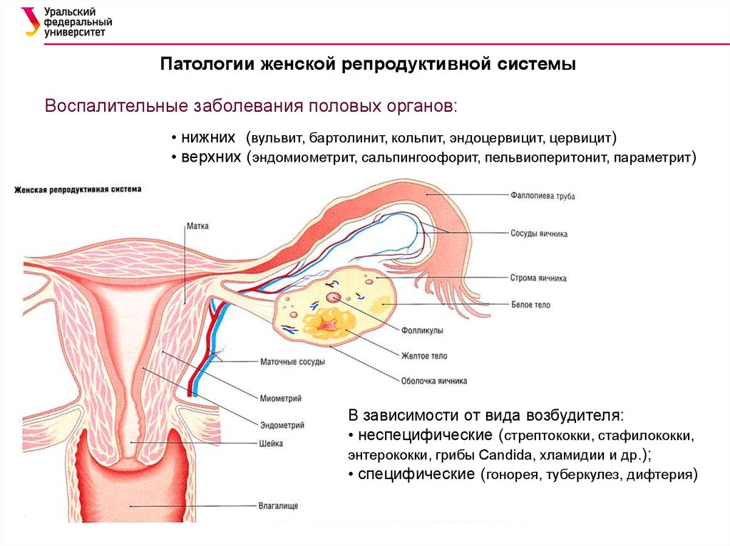 Репродуктивные заболевания у женщин