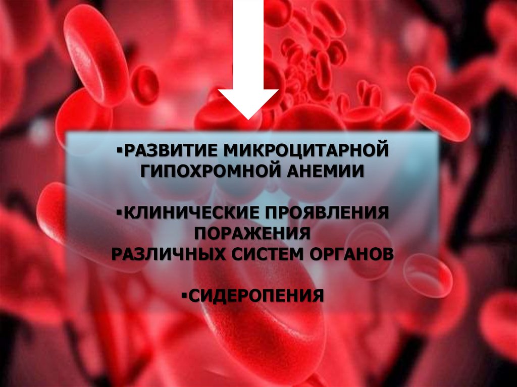 Микроцитарная анемия это. Гипохромные микроцитарные анемии. Железодефицитная анемия гипохромная микроцитарная. Причины гипохромной микроцитарной анемии. Микроцитарные анемии презентация.
