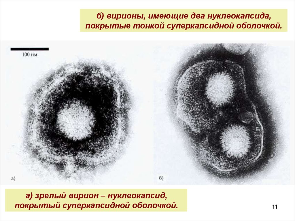 Вакцина от марека. Вирион нуклеокапсид. Формирование вирионов. Вирионы заболевания.