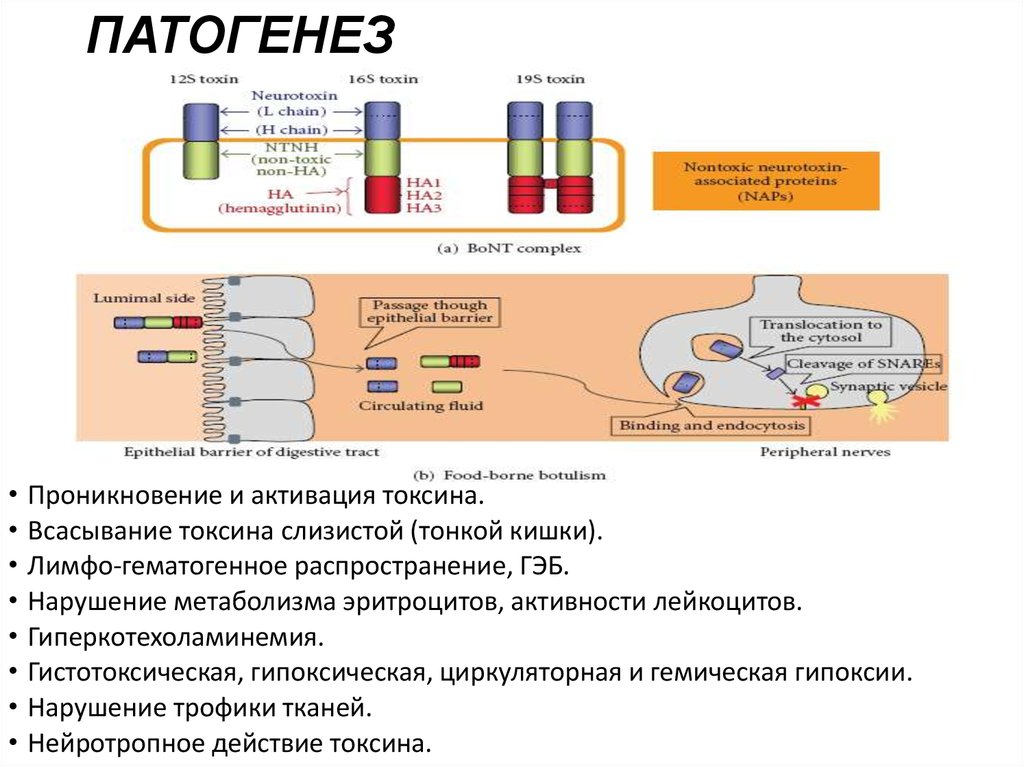 Патогенез ботулизма картинки