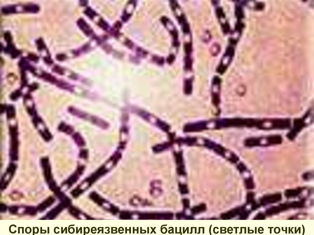 Окраска спор бактерий. Морфология бациллы сибирской язвы. Bacillus anthracis Сибирская язва. Бациллы сибирской язвы микроскопия. Сибиреязвенная бацилла микробиология.