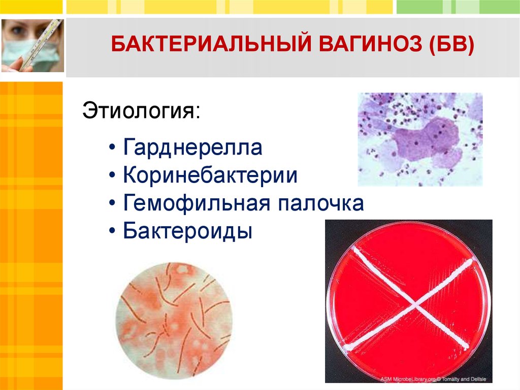 После лечения вагиноза. Бактериальный вагиноз этиология. Этиология бактериального вагиноза.