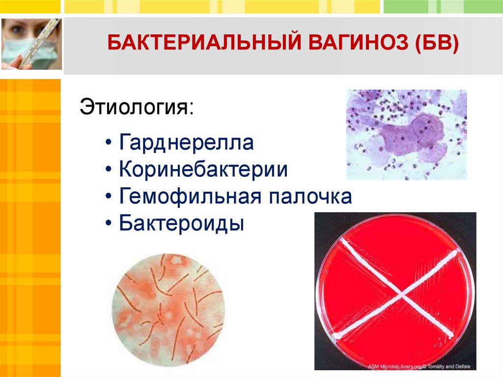 Диагностика бактериального вагиноза