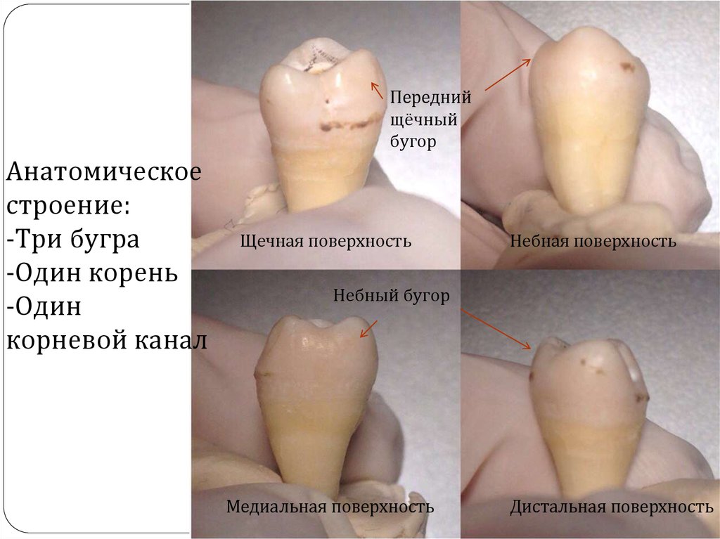 Эндодонтическое лечение зуба 28 - презентация онлайн