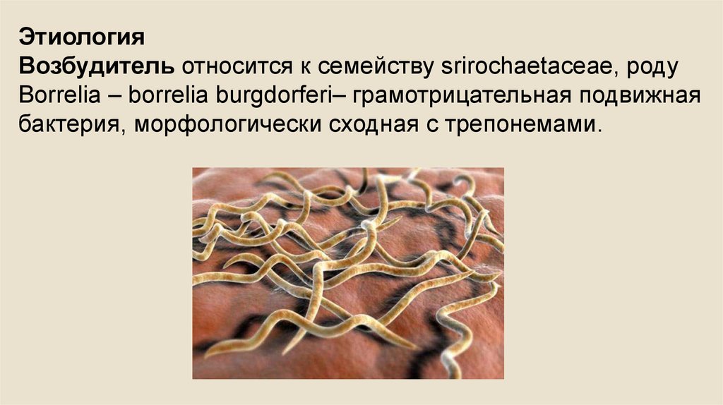 Borrelia burgdorferi igg. Возбудитель боррелиоза. Клещевой боррелиоз возбудитель. Лайм боррелиоз возбудитель.