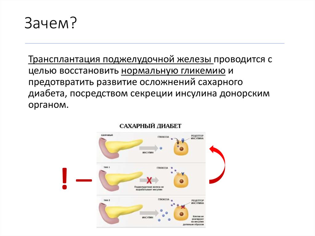 Пересадка поджелудочной железы при сахарном. Трансплантация поджелудочной железы. Трансплантация поджелудочной железы показания. Пересадка поджелудочной железы показания. Трансплантация поджелудочной железы в России.